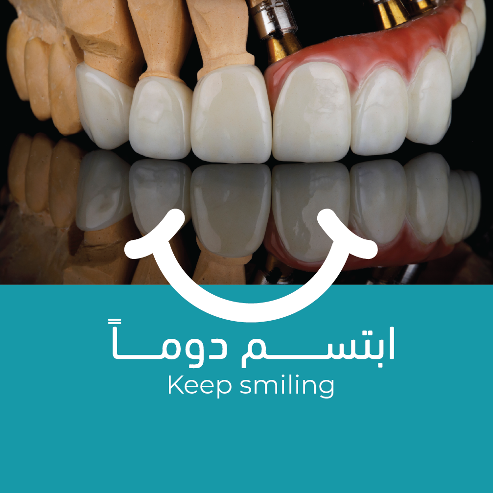 زراعة الأسنان